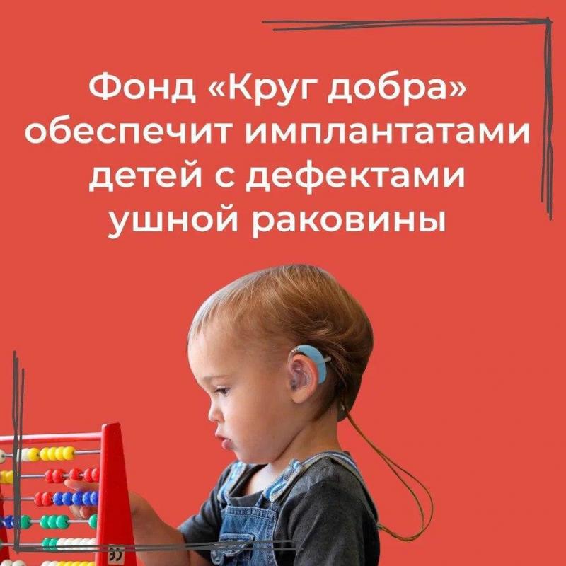 Президентский фонд «Круг добра» обеспечит имплантатами детей с дефектами ушной раковины